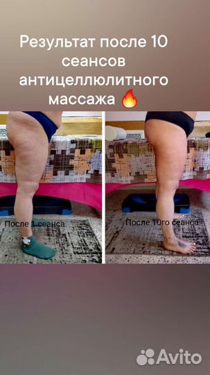 Массаж