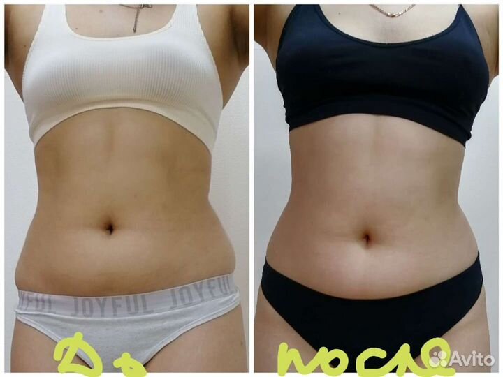 Косметология,коррекция фигуры