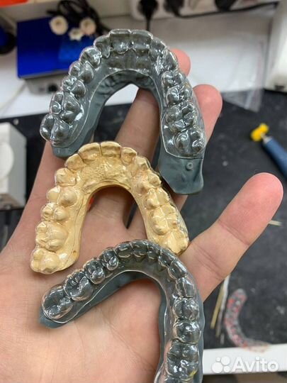 Изготовление съемных протезов