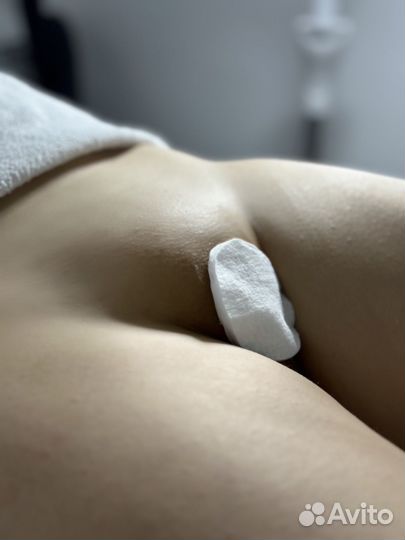 Нужны модели на лазерную эпиляцию