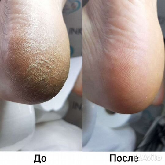 Маникюр, педикюр