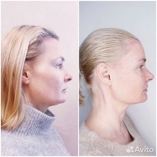 Скульптурный массаж лица