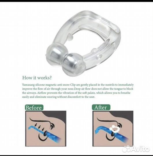 Приспособление от храпа