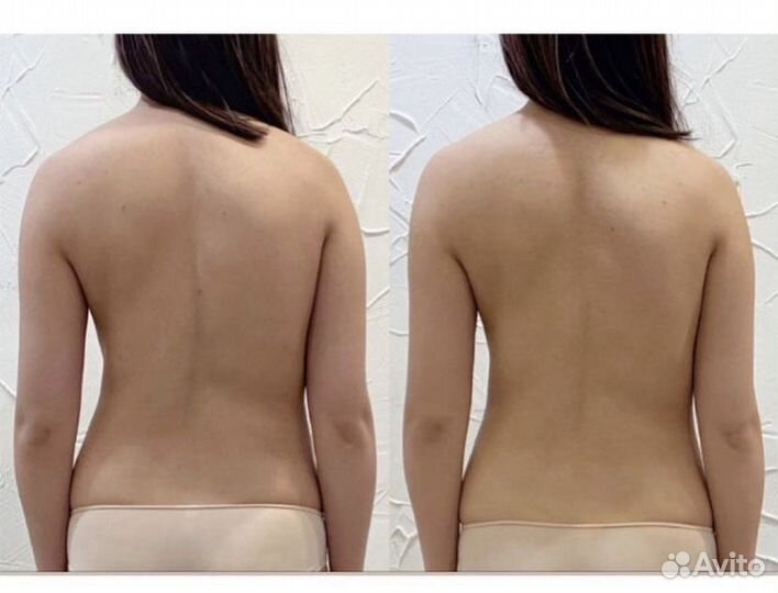 Массаж лица и тела Остеопластика