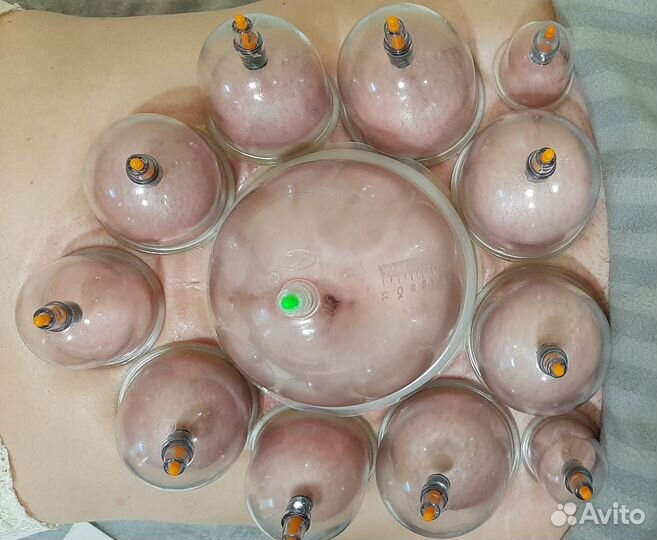 Висцеральный массаж Гуа-ша Баночный