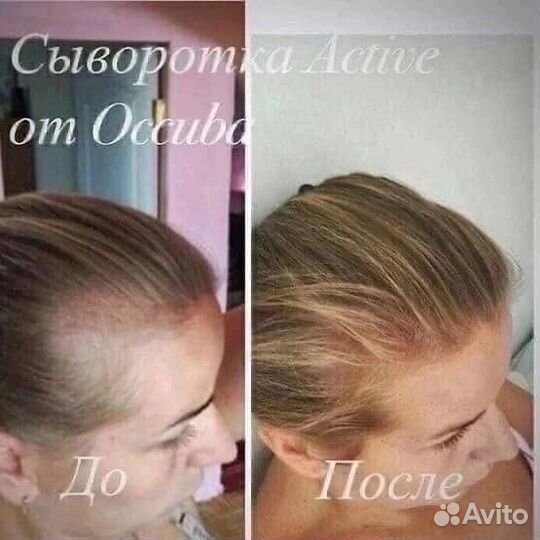 Сыворотка для роста волос