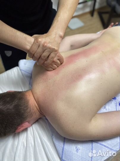 Миопрессура / Массаж триггерных точек