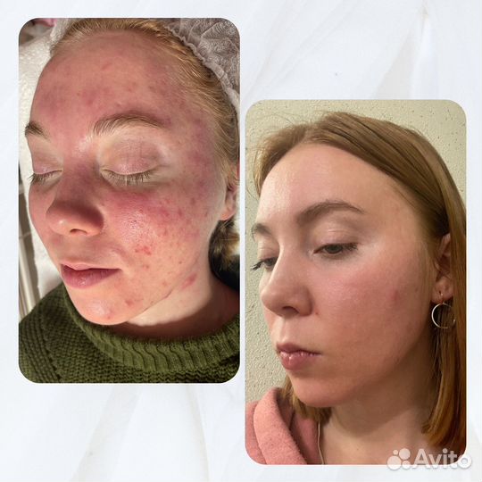 Услуги косметолога