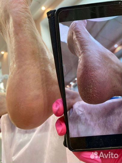 Маникюр, педикюр покрытие гель лаком