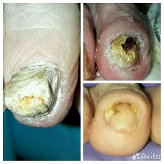 Подолог(химки,куркино,новогорск),подолог(выезд)