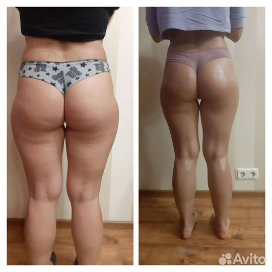 Массаж тела,массаж лица,кавитация,rf лифтинг