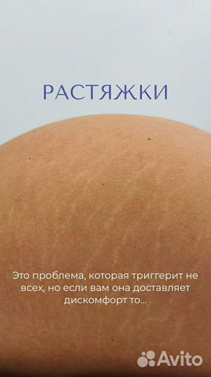 Микроигольчатый RF лифтинг