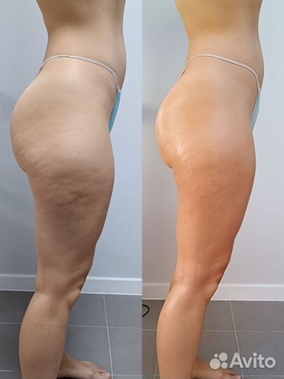 Массаж + кедровая бочка сауна. Супер эффект