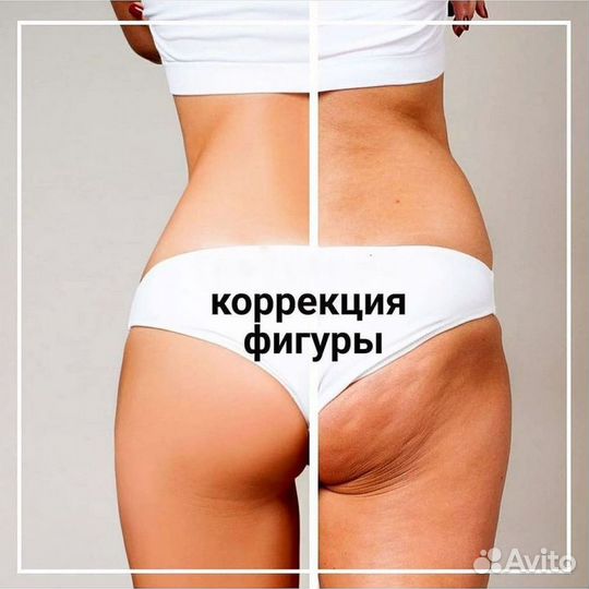 Коррекция фигуры, антицеллюлитный массаж