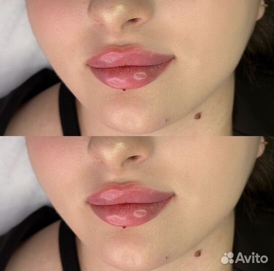 Губы,лицо под ключ,full face,профиль джоли