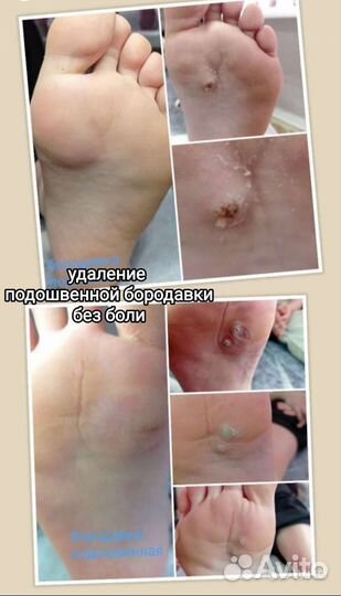 Подолог. Медицинский педикюр