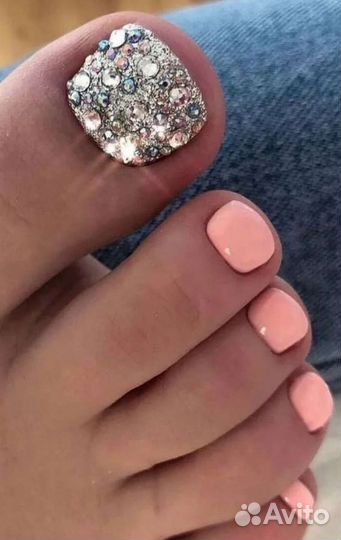 Педикюр Титановая нить Вросший ноготь Онихолизис