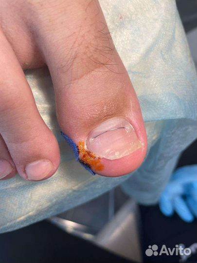 Педикюр/Подология