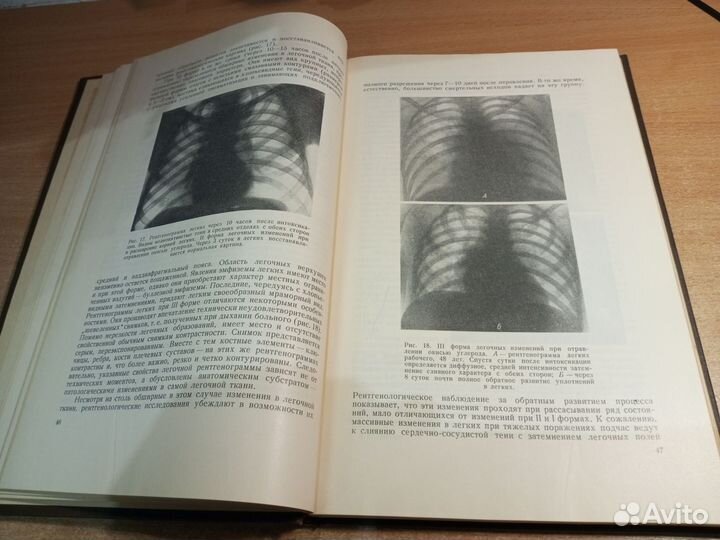 Рентгенодиагностика проф.болезней