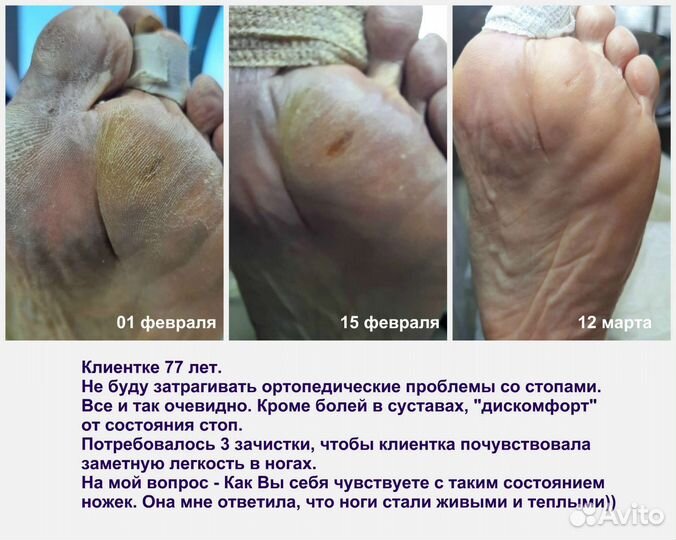 Услуги подолога