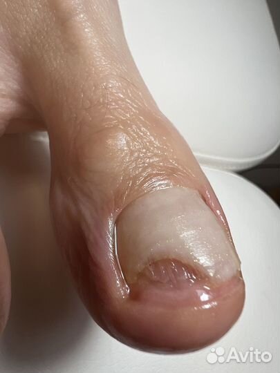 Бесплатная консультация подолога