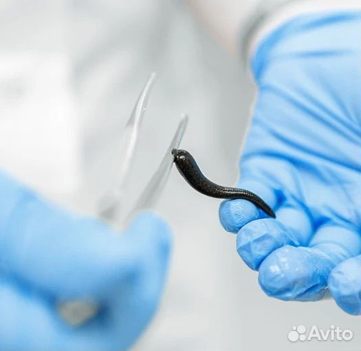 Купон на гирудотерапию