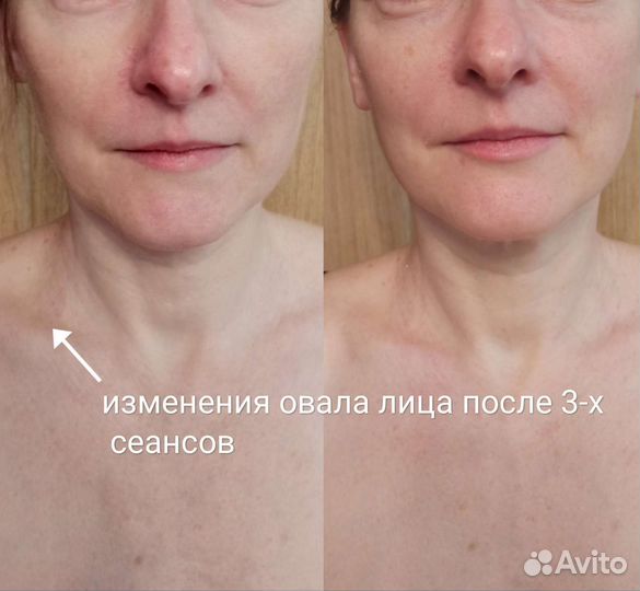 Массаж лица и тела