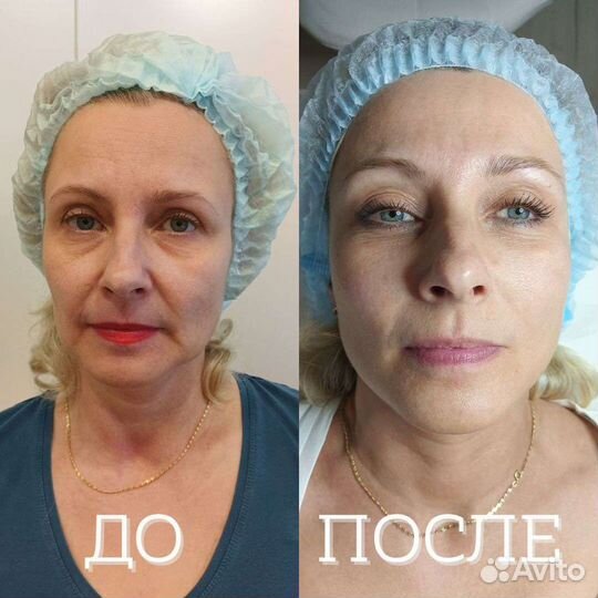 Консультация косметолога