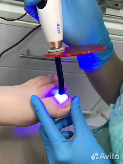 Подолог / Лечебный педикюр