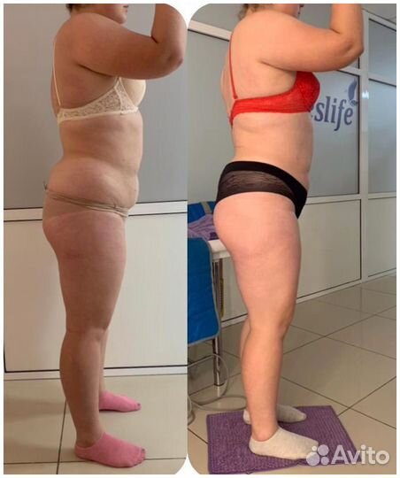 Коррекция фигуры и омоложение 7в1