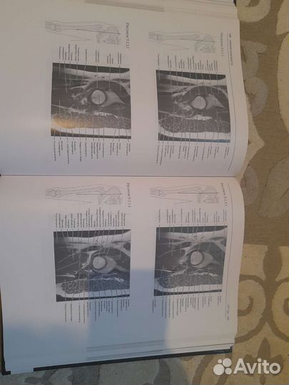 Книга по лучевой диагностике