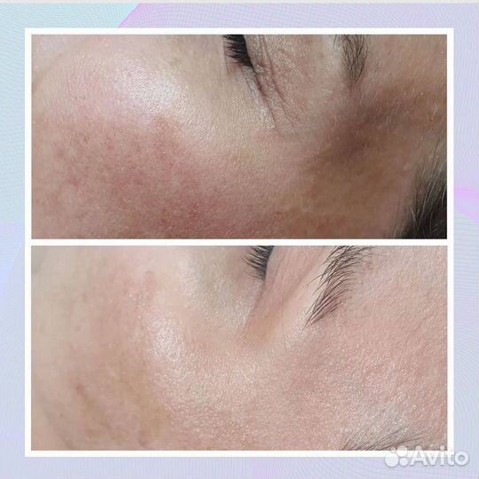 Dermadrop