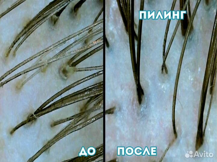Обучение кератин ботокс полировка бустап