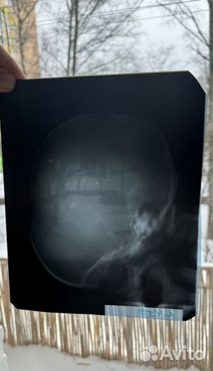 Рентгеновские снимки