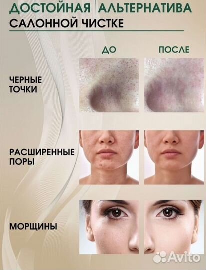 Ультразвуковой аппарат для чистки лица