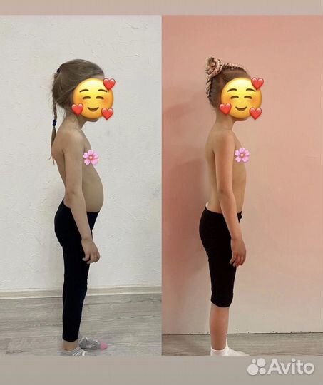 Коррекция осанки