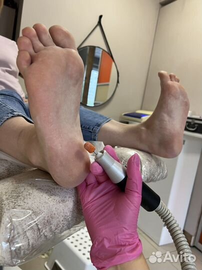 Усложненный педикюр