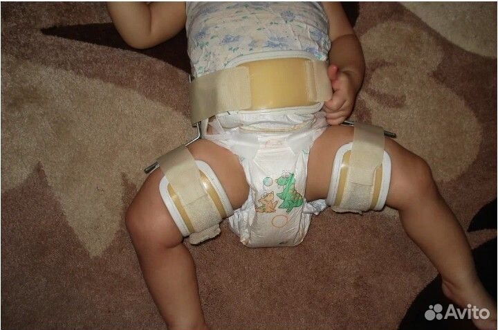 Ортез тазобедренный отводящий