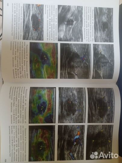 Книги по медицине, рентгенология