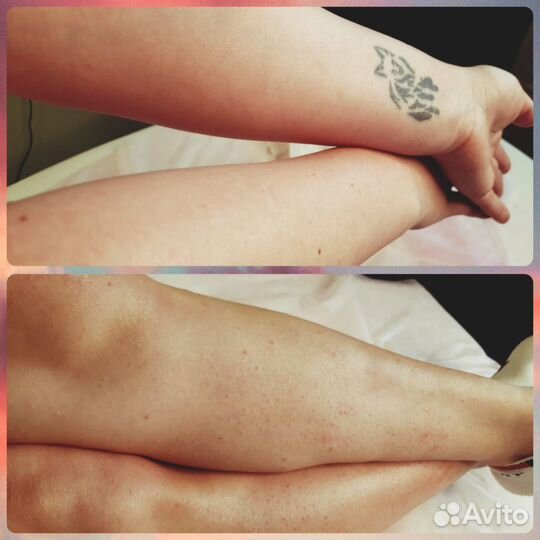 Шугаринг на дому