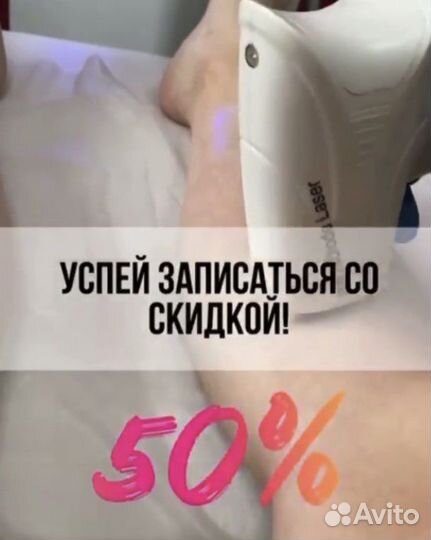 Лазерная эпиляция