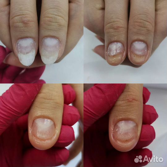 Подолог Бутово. Услуги подолога