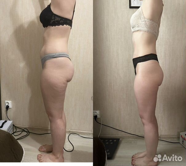 Услуга «лежи И худей»