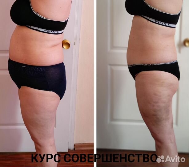 Аппаратная коррекция фигуры