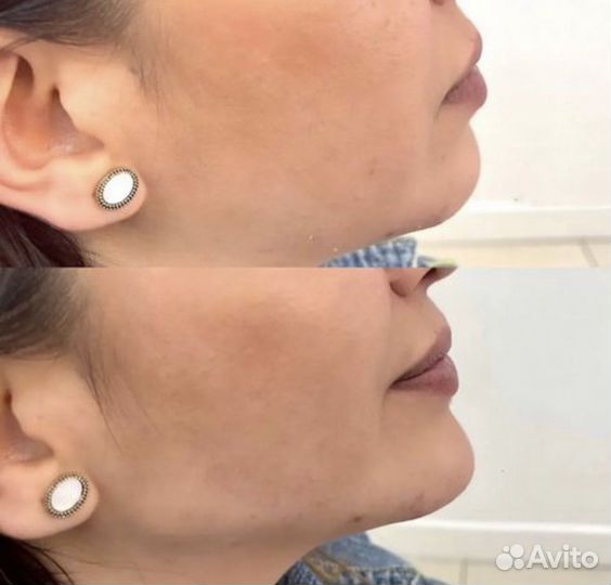 Обучение, практика для косметологов