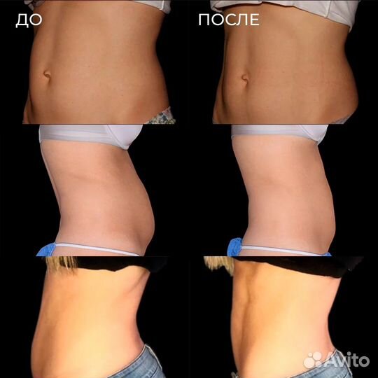 Для коррекции фигуры и стимуляции мышц