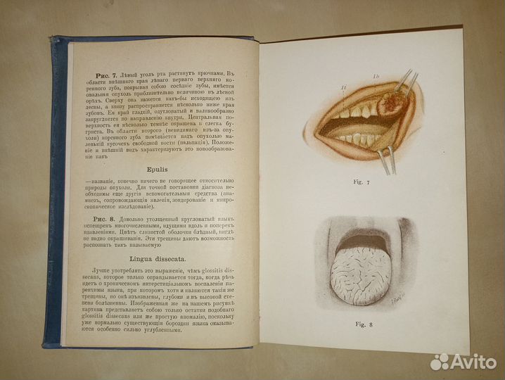 Карманный медицинский атлас т. 5. Болезни рта.1895