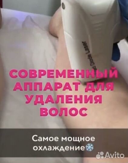 Лазерная эпиляция