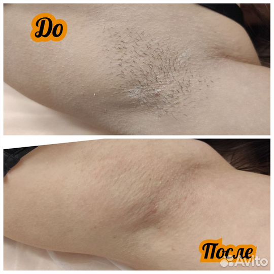 Модель на шугаринг