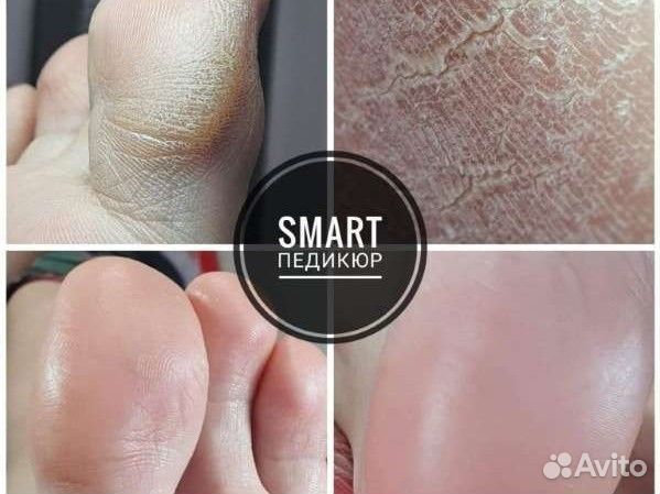 Педикюр smart/ маникюр
